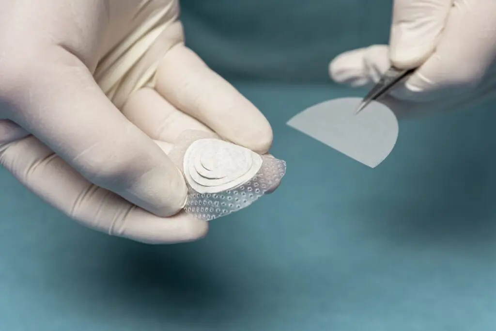 Kerecis fish skin graft being applied in clinical setting