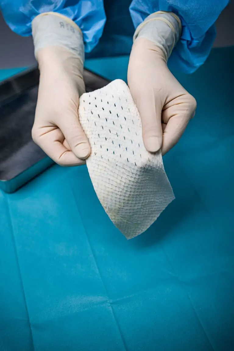 Kerecis SurgiBind for soft tissue reinforcement and tendon protection